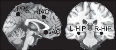 Fronto-medial electrode placement for electroconvulsive treatment of depression